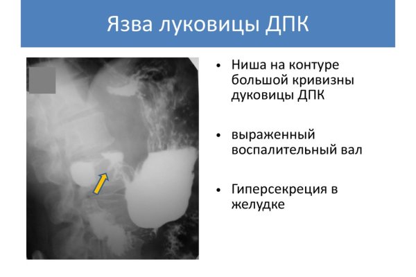 Кракен наркоплейс